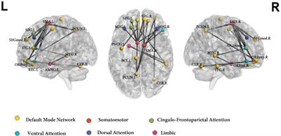 Intrinsic Functional Connectivity in the Default Mode Network Differentiates the Combined and Inattentive Attention Deficit Hyperactivity Disorder Types